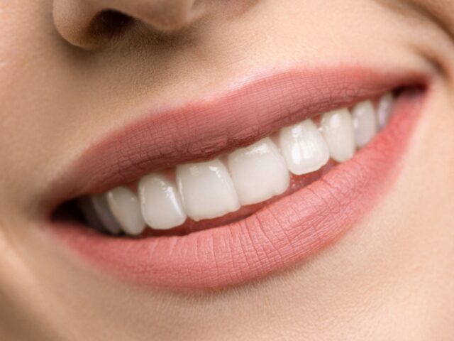 https://szedinadental.hu/wp-content/uploads/2022/09/pexels-shiny-diamond-3762441-640x480.jpg